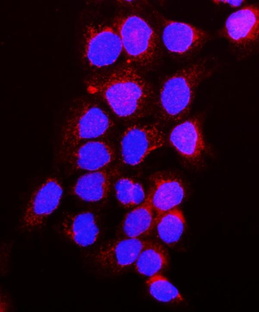 VEGF Receptor 1/FLT1 Rabbit Polyclonal Antibody