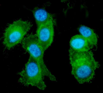 Eph receptor A2/EPHA2 Rabbit Polyclonal Antibody