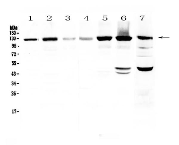 Eph receptor A2/EPHA2 Rabbit Polyclonal Antibody