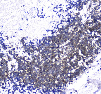L1CAM Antibody