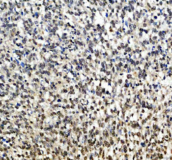 SOX10 Rabbit Polyclonal Antibody