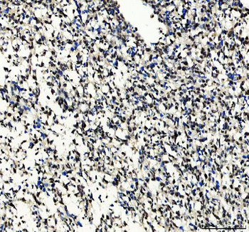 SOX10 Rabbit Polyclonal Antibody