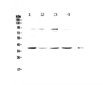 Ogg1 Rabbit Polyclonal Antibody