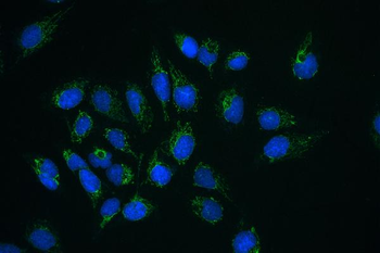 CLPX Rabbit Polyclonal Antibody