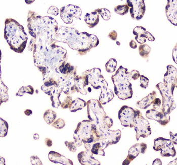 CLPX Rabbit Polyclonal Antibody