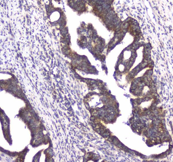 CLPX Rabbit Polyclonal Antibody