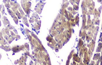CLPX Rabbit Polyclonal Antibody