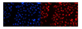 splicing factor 1/SF1 Antibody