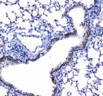 splicing factor 1/SF1 Antibody
