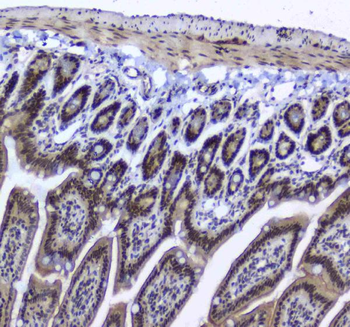 splicing factor 1/SF1 Antibody