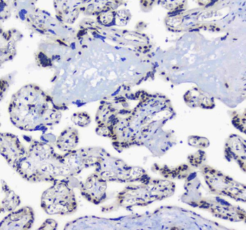 splicing factor 1/SF1 Antibody