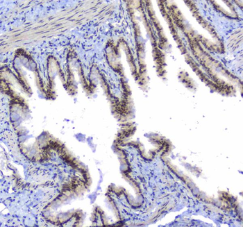 splicing factor 1/SF1 Antibody