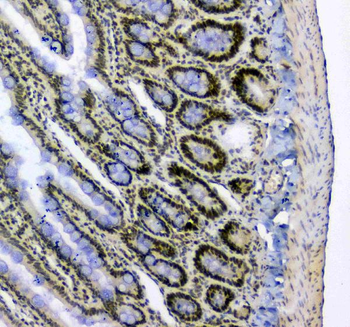 splicing factor 1/SF1 Antibody