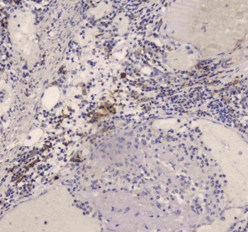 DC-SIGN/CD209 Antibody