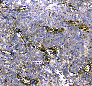 MYBPC3 Rabbit Polyclonal Antibody