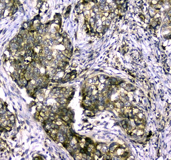 MYBPC3 Rabbit Polyclonal Antibody