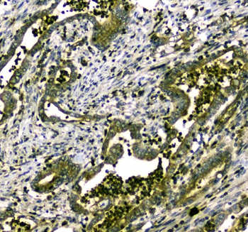 MYBPC3 Rabbit Polyclonal Antibody