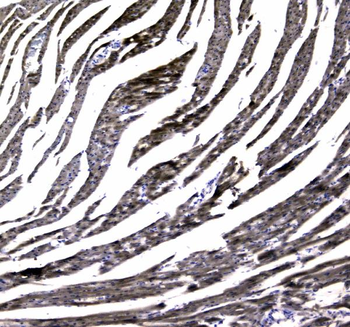 MYBPC3 Rabbit Polyclonal Antibody
