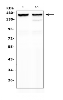 MYBPC3 Rabbit Polyclonal Antibody