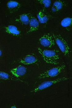 SDHB Rabbit Polyclonal Antibody