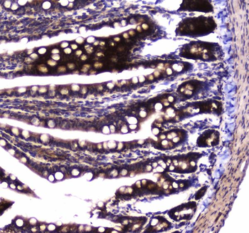 SDHB Rabbit Polyclonal Antibody