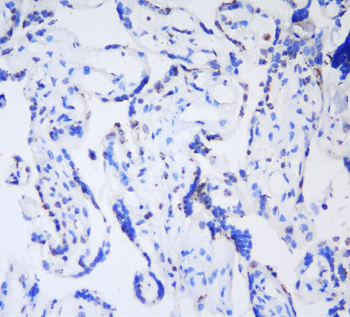 HP1 gamma/CBX3 Antibody