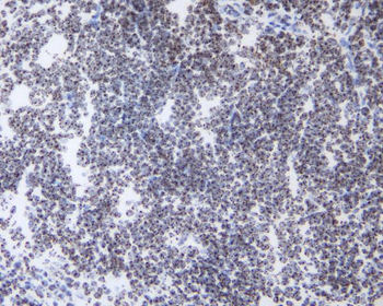 HP1 gamma/CBX3 Antibody