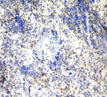 HP1 gamma/CBX3 Antibody