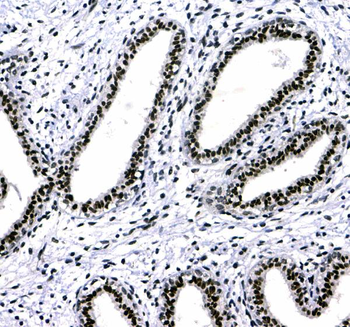 HP1 gamma/CBX3 Antibody