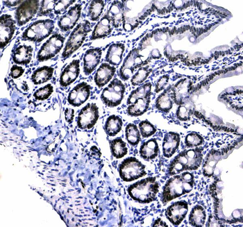 HP1 gamma/CBX3 Antibody