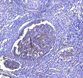 TAPA1/CD81 Rabbit Polyclonal Antibody
