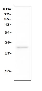 TAPA1/CD81 Rabbit Polyclonal Antibody