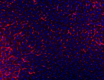 TAPA1/Cd81 Rabbit Polyclonal Antibody