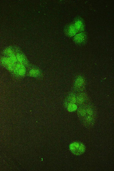 SMC6L1 Rabbit Polyclonal Antibody