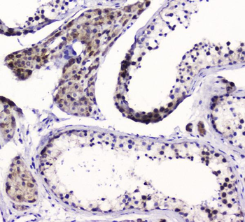 SMC6L1 Rabbit Polyclonal Antibody