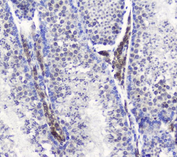 SMC6L1 Rabbit Polyclonal Antibody