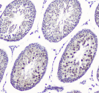 SMC6L1 Rabbit Polyclonal Antibody