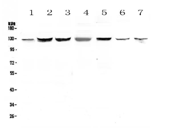 SMC6L1 Rabbit Polyclonal Antibody