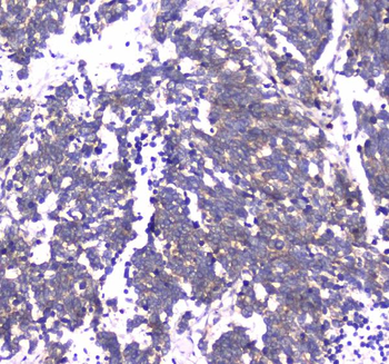 RAB27A Rabbit Polyclonal Antibody