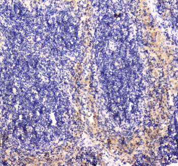 RAB27A Rabbit Polyclonal Antibody