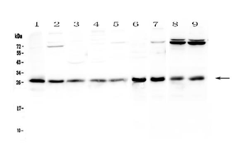 RAB27A Rabbit Polyclonal Antibody