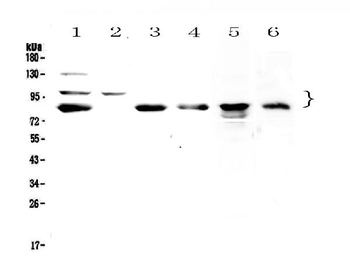 TPX2 Rabbit Polyclonal Antibody