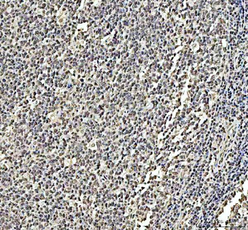 DCK Rabbit Polyclonal Antibody