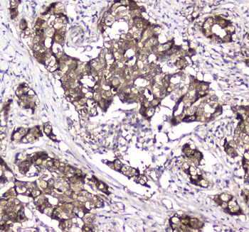GLO1 Antibody