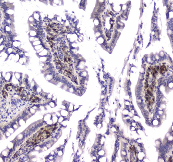 GLO1 Antibody