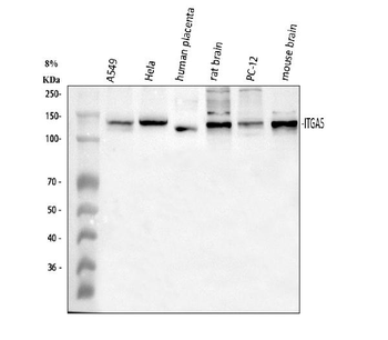 Integrin alpha 5/ITGA5 Rabbit Polyclonal Antibody