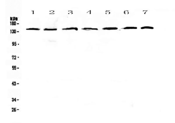 PERK/EIF2AK3 Rabbit Polyclonal Antibody