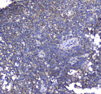 Synaptotagmin 1/SYT1 Antibody