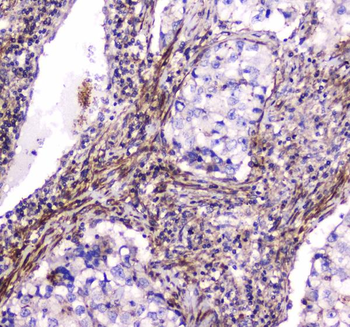 Dynamin 1/DNM1 Antibody
