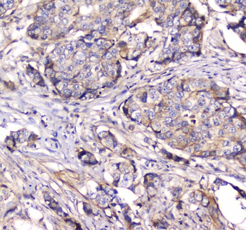 Dynamin 1/DNM1 Antibody